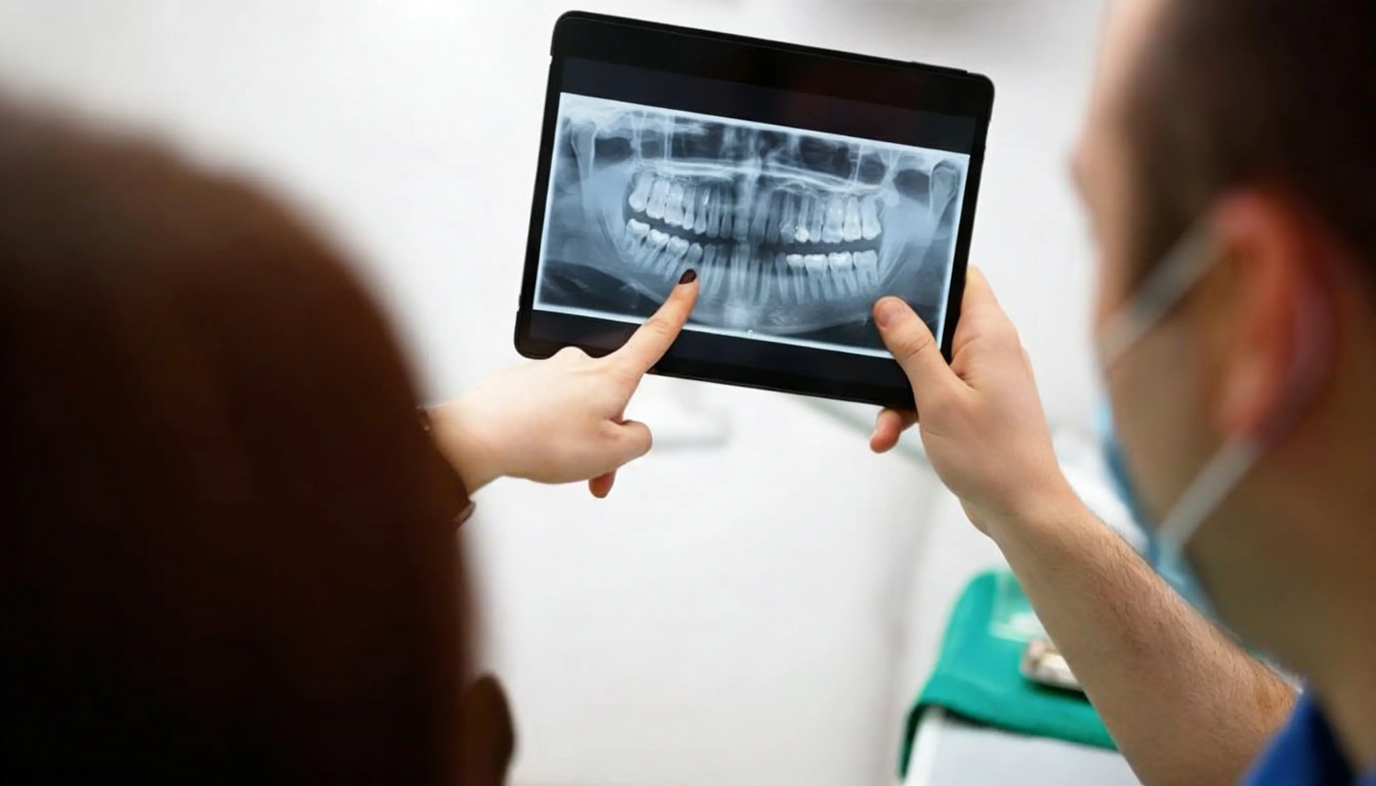 Extraction Tooth Removal